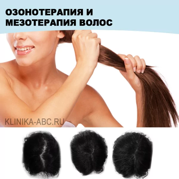 Озонотерапия и мезотерапия волос